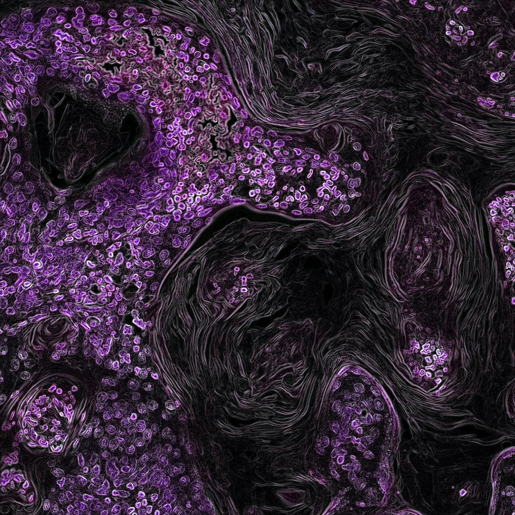 Seamless mirror wallpaper pattern — Biochemistry by wallpaper⁶ — base photo: Kras-Driven Lung Cancer. Created by Eric Snyder, 2015.