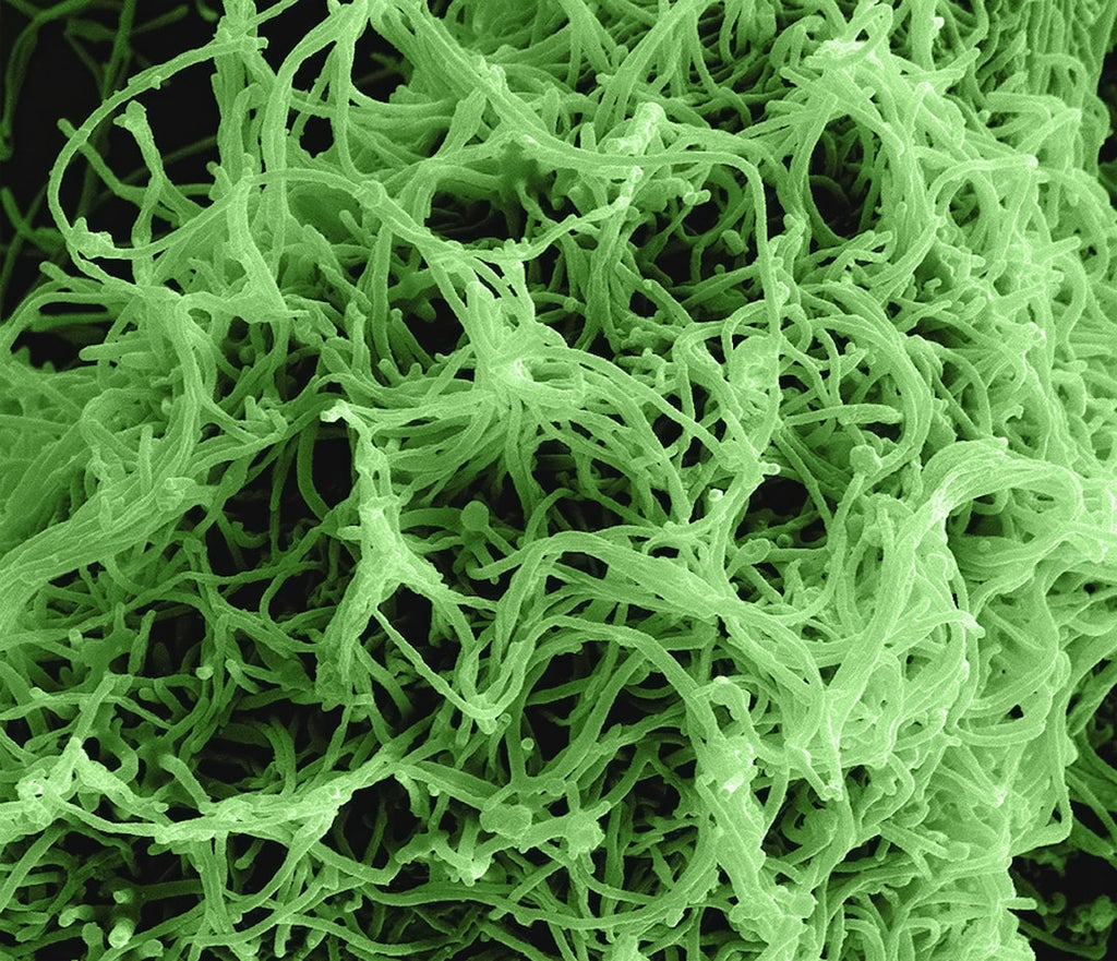 Biology Kaleidoscope wallpaper pattern — base photo: Ebola Virus Particles Colorized scanning electron micrograph of filamentous Ebola virus particles bu
