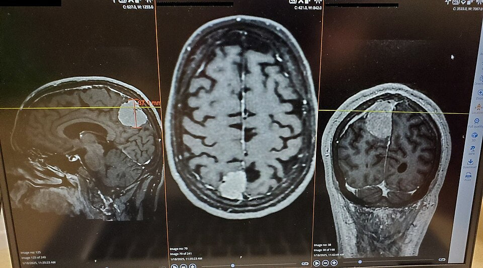 Seamless hex wallpaper pattern — Medicine by wallpaper⁶ — base photo: File:Brain Tumor MRI.jpg