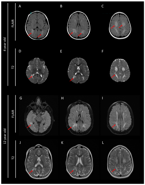 Seamless mirror wallpaper pattern — Medicine by wallpaper⁶ — base photo: File:Cerebral Folate Deficiency - Brain MRI performed at 4 and 12 years old.png