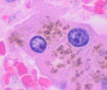 Seamless kaleidoscope wallpaper pattern — Medicine by wallpaper⁶ — base photo: File:Histology of hepatocyte lipofuscin.jpg