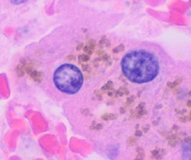 Seamless kaleidoscope wallpaper pattern — Medicine by wallpaper⁶ — base photo: File:Histology of hepatocyte lipofuscin.jpg